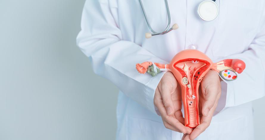 Doctor holding Uterus and Ovaries model. Ovarian and Cervical cancer, Cervix disorder, Endometriosis, Hysterectomy, Uterine fibroids, Reproductive system and Pregnancy concept